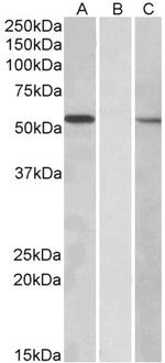 MGAT1 Antibody in Western Blot (WB)