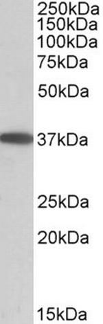 MOGAT2 Antibody in Western Blot (WB)