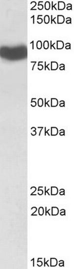 Cytochrome P450 Reductase Antibody in Western Blot (WB)