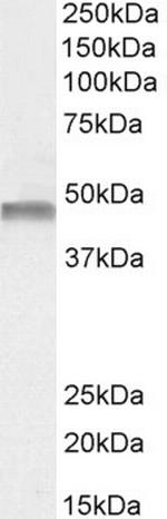 PAH Antibody in Western Blot (WB)