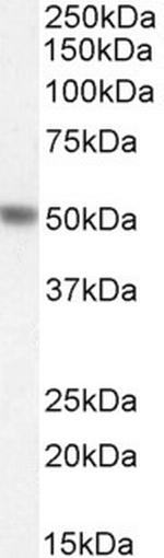 PAH Antibody in Western Blot (WB)