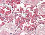 RHCG Antibody in Immunohistochemistry (Paraffin) (IHC (P))