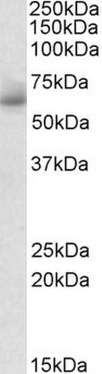 RHCG Antibody in Western Blot (WB)