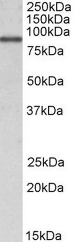 ALDH18A1 Antibody in Western Blot (WB)