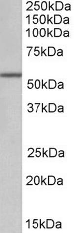 ALDH6A1 Antibody in Western Blot (WB)