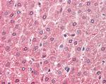 ALDH6A1 Antibody in Immunohistochemistry (Paraffin) (IHC (P))