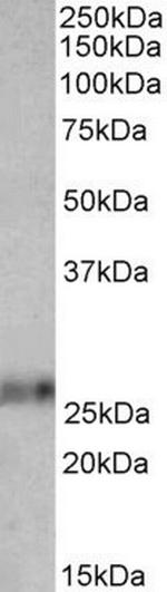 Ephrin A1 Antibody in Western Blot (WB)