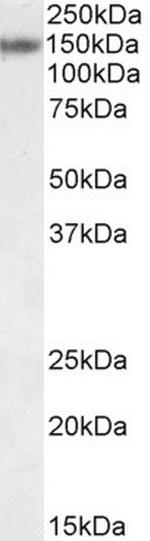 Rbm20 Antibody in Western Blot (WB)