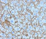 beta Catenin Antibody in Immunohistochemistry (Paraffin) (IHC (P))