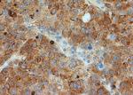 GRP78 Antibody in Immunohistochemistry (Paraffin) (IHC (P))