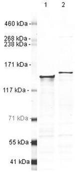 DHX9 Antibody in Western Blot (WB)