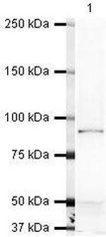 VE-cadherin Antibody in Western Blot (WB)