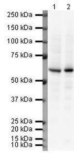 CES1 Antibody in Western Blot (WB)