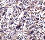 STAT1 Antibody in Immunohistochemistry (Paraffin) (IHC (P))