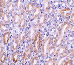 DFFB Antibody in Immunohistochemistry (IHC)