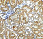 DFFB Antibody in Immunohistochemistry (IHC)