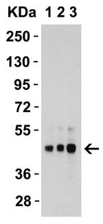 TRAIL-R2 (DR5) Antibody in Western Blot (WB)