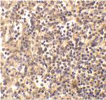 DNase II Antibody in Immunohistochemistry (IHC)