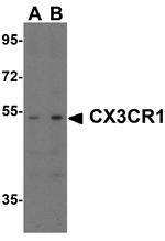 CX3CR1 Antibody in Western Blot (WB)