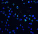 DFFB Antibody in Immunocytochemistry (ICC/IF)