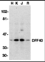 DFFB Antibody in Western Blot (WB)