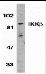 IKK beta Antibody in Western Blot (WB)