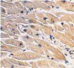 MyD88 Antibody in Immunohistochemistry (Paraffin) (IHC (P))