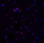 MyD88 Antibody in Immunocytochemistry (ICC/IF)