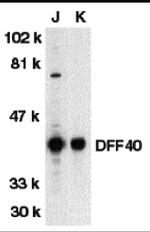 DFFB Antibody in Western Blot (WB)