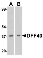 DFFB Antibody in Western Blot (WB)