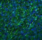 CXCR6 Antibody in Immunohistochemistry (IHC)