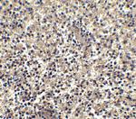 CXCR6 Antibody in Immunohistochemistry (IHC)