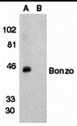 CXCR6 Antibody in Western Blot (WB)