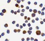 Acinus Antibody in Immunocytochemistry (ICC/IF)