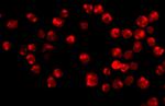 Acinus Antibody in Immunocytochemistry (ICC/IF)