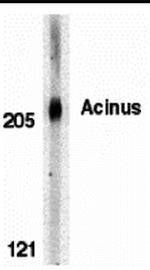 Acinus Antibody in Western Blot (WB)