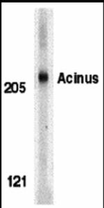 Acinus Antibody in Western Blot (WB)