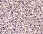 F1A alpha Antibody in Immunohistochemistry (IHC)