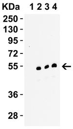 RIP3 Antibody in Western Blot (WB)