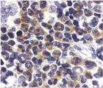 DAPK2 Antibody in Immunohistochemistry (IHC)