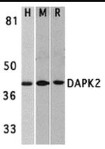 DAPK2 Antibody in Western Blot (WB)