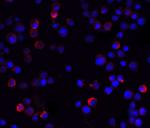 IKK gamma Antibody in Immunocytochemistry (ICC/IF)