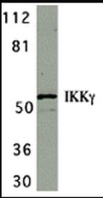 IKK gamma Antibody in Western Blot (WB)