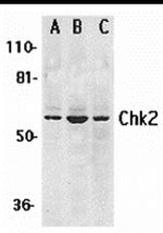 CHK2 Antibody in Western Blot (WB)