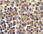 BCMA Antibody in Immunohistochemistry (Paraffin) (IHC (P))