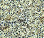 BCMA Antibody in Immunohistochemistry (Paraffin) (IHC (P))