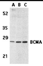 BCMA Antibody in Western Blot (WB)