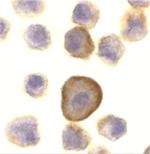 PERP Antibody in Immunocytochemistry (ICC/IF)