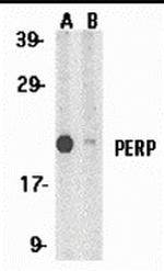 PERP Antibody in Western Blot (WB)