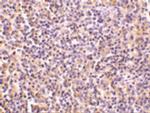 TCCR Antibody in Immunohistochemistry (IHC)